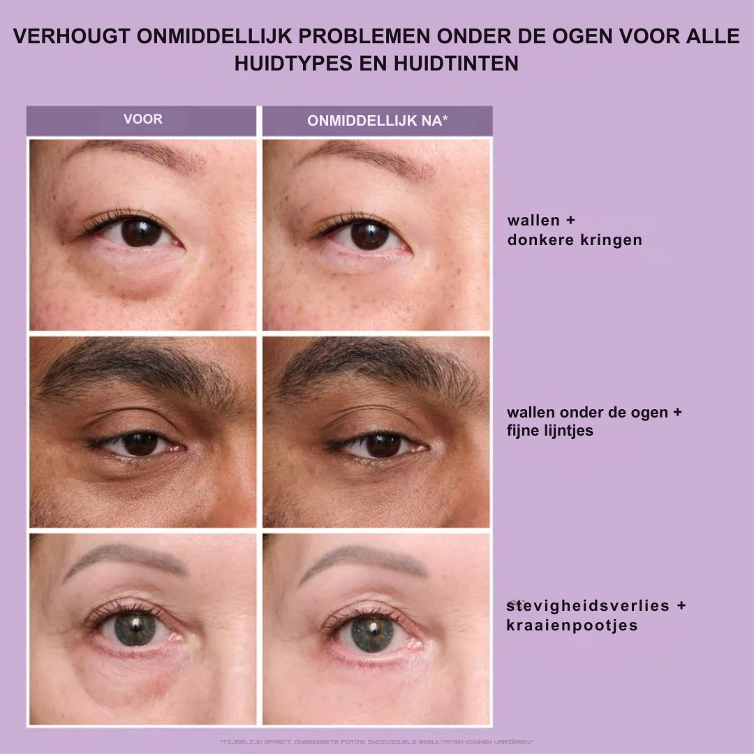 FirmX-  Vice Lift in a Blink