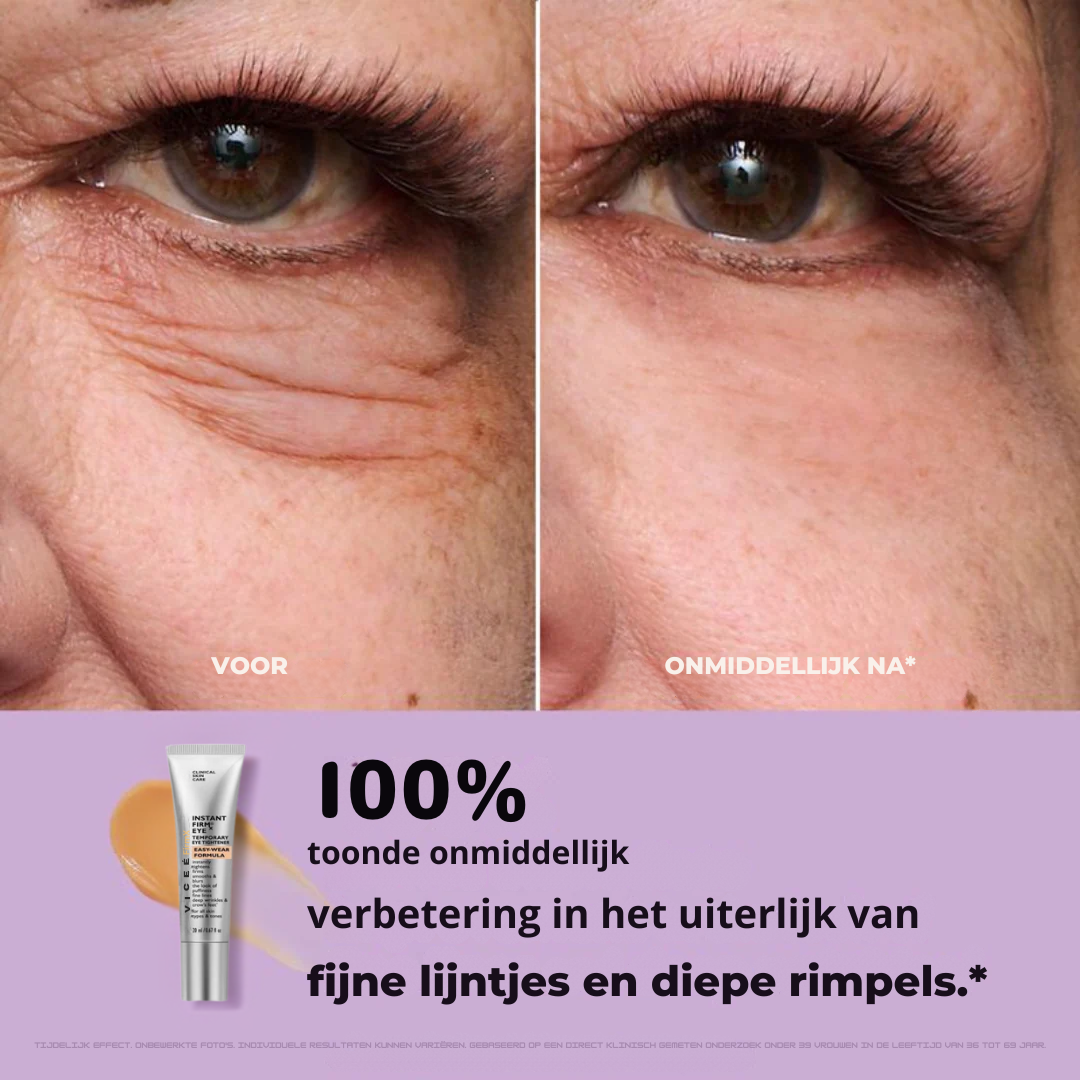 FirmX-  Vice Lift in a Blink
